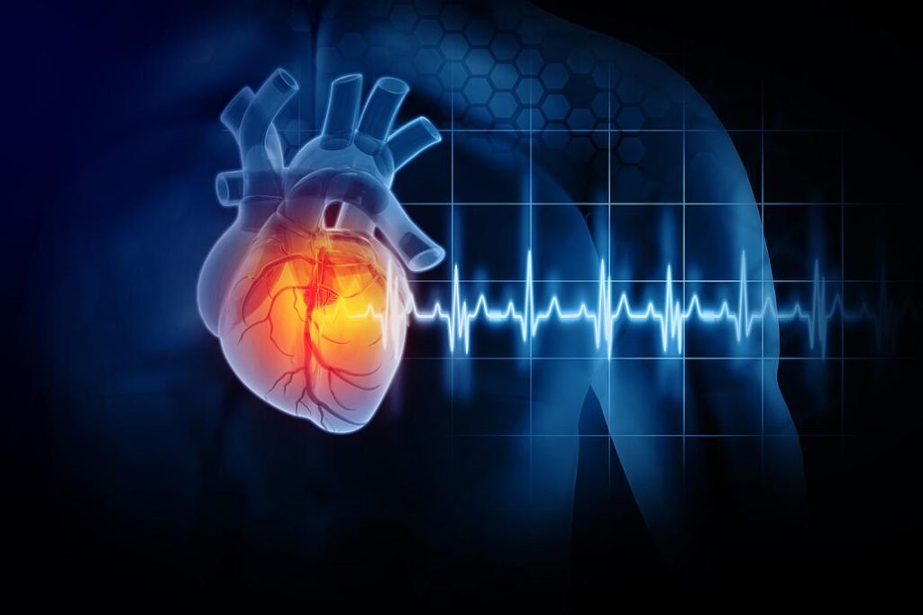 MoU signed between NIT Board and PSIC for prevention of heart diseases